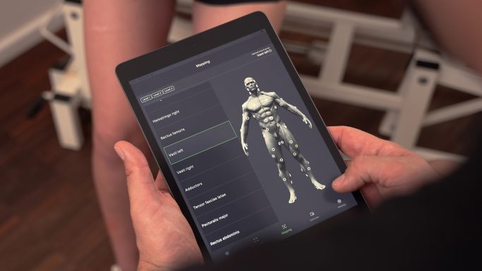 Nutzungsbeispiel der myoact App