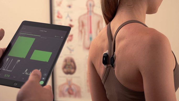 Nutzungsbeispiel der myoact App