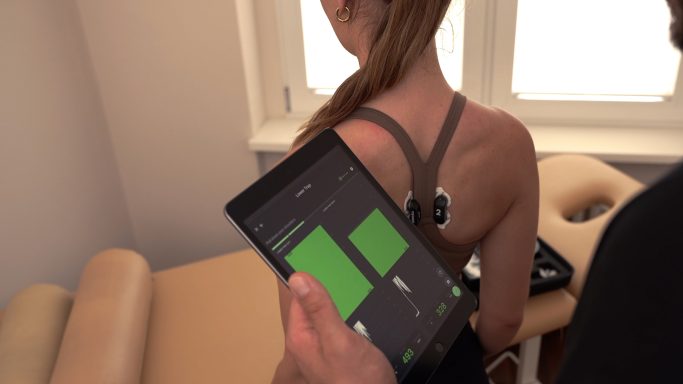 Nutzungsbeispiel der myoact App